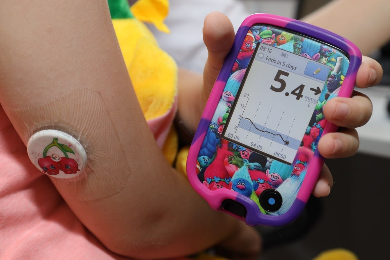 В Подмосковье детей с сахарным диабетом обеспечили устройством для постоянного мониторинга глюкозы 