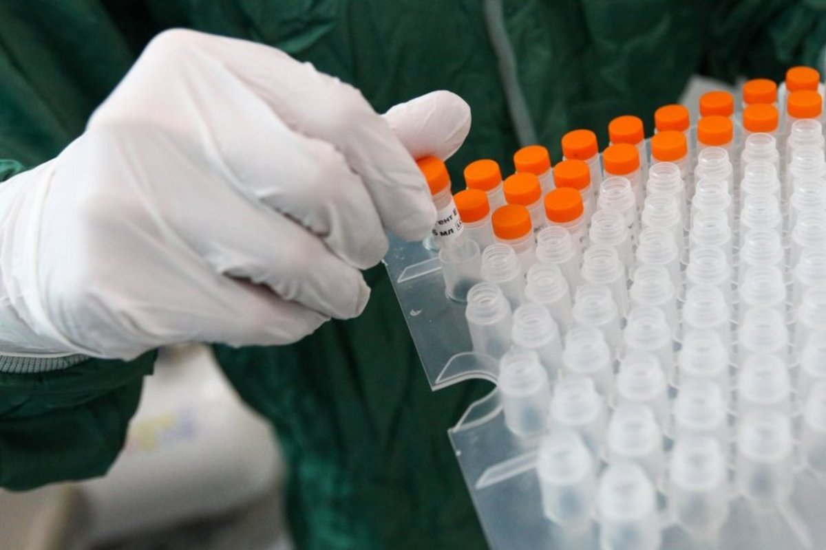 В России зарегистрировано 1175 новых случаев заражения коронавирусом