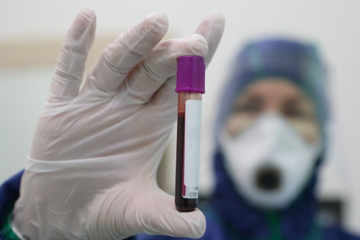 В России взяли свыше 5,2 миллионов тестов на коронавирус