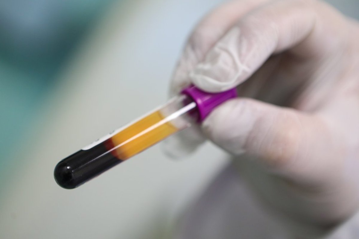 В России проведено свыше 8,6 миллионов тестов на коронавирус