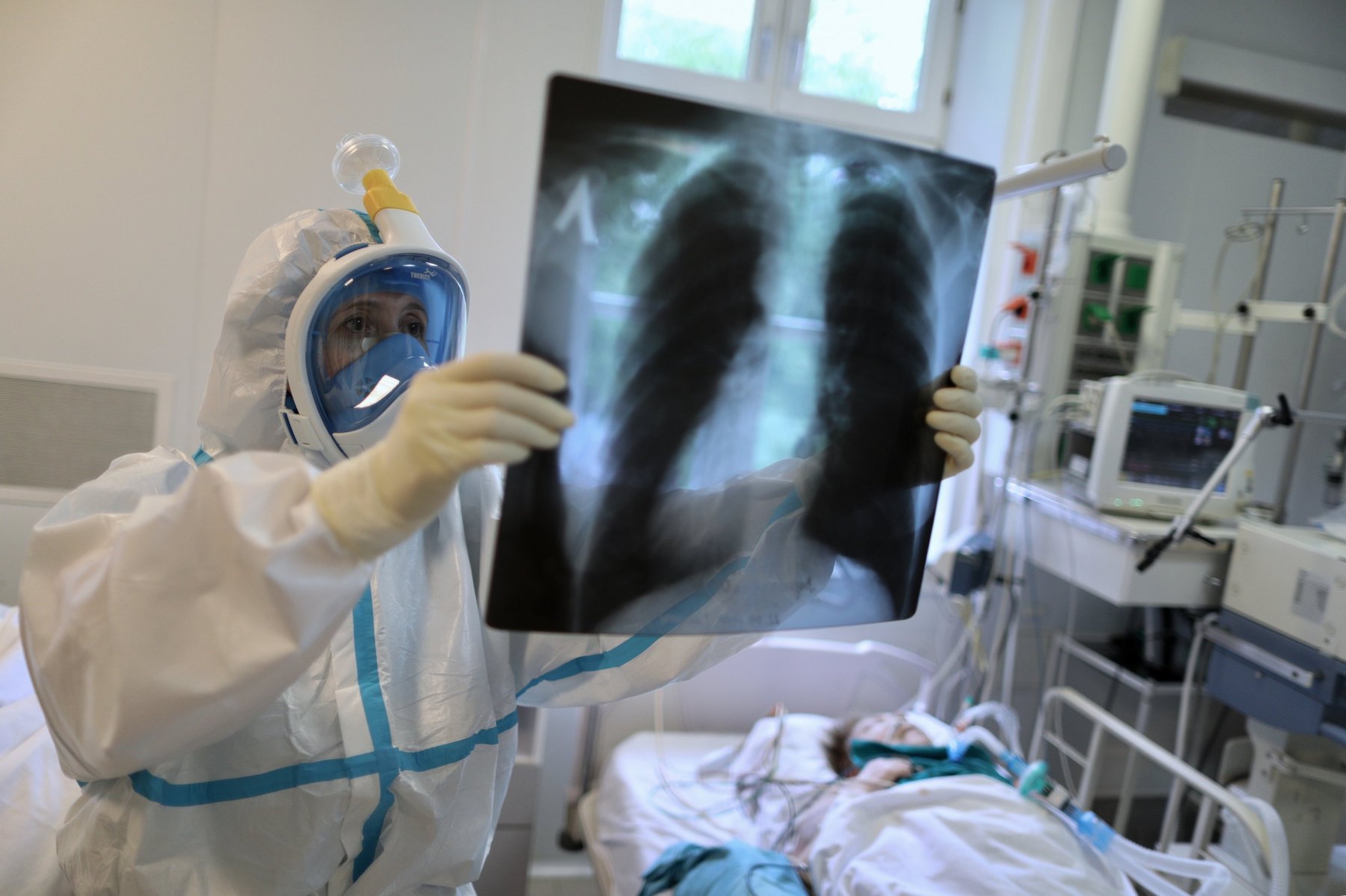 Свыше 500 московских врачей-рентгенологов пользуются в работе помощью искусственного интеллекта 