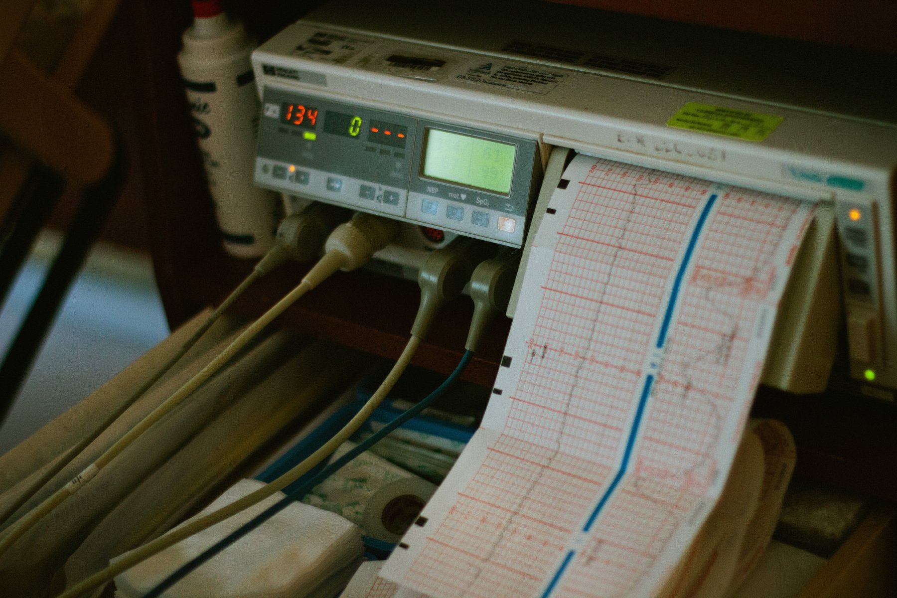 Бригадам скорой помощи в Подмосковье помогает кардиопульт 