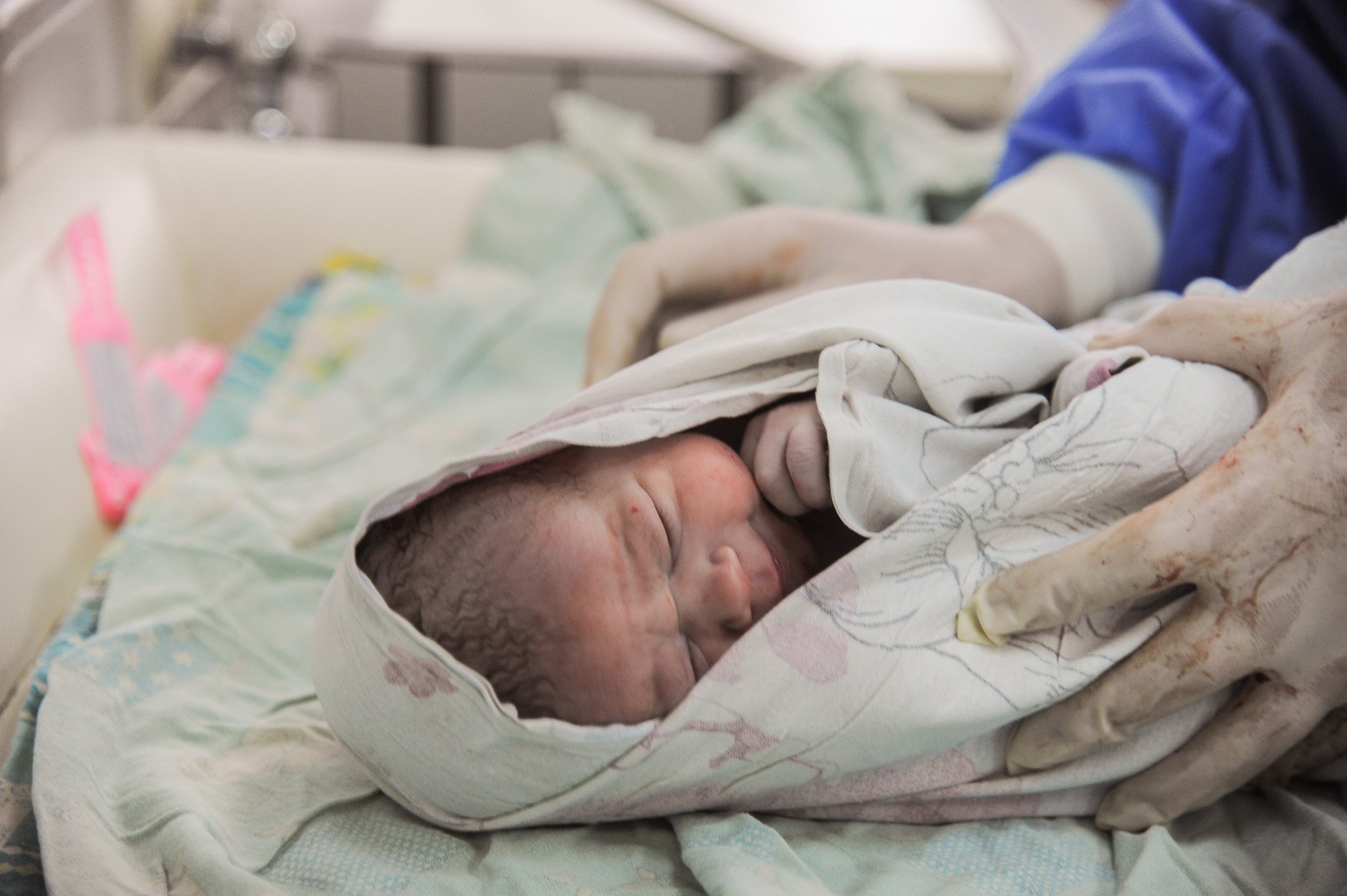 В Подмосковье удалили опухоль у новорожденного ребенка