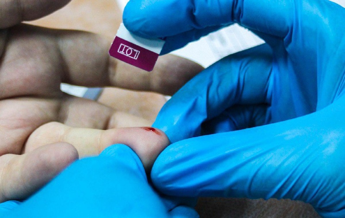 В Подмосковье свыше 2 млн человек сдали тест на ВИЧ с начала года 