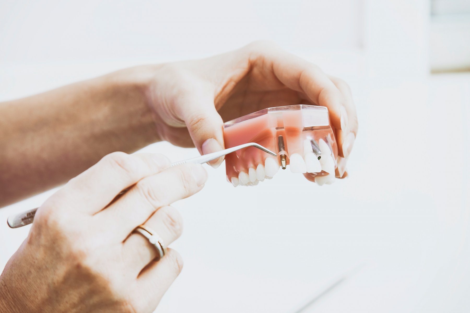 Бесплатно ставить зубные протезы в Подмосковье смогут инвалиды, проживающие в соцучреждениях