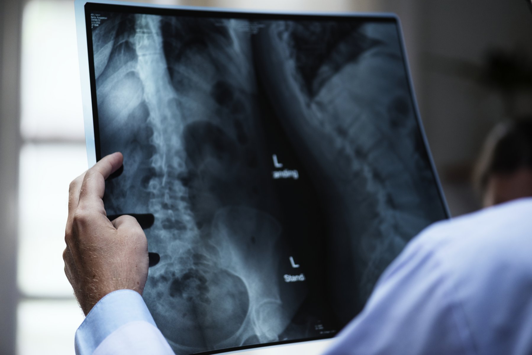 Новый рентгеноаппарат заработал в Краснознаменской поликлинике