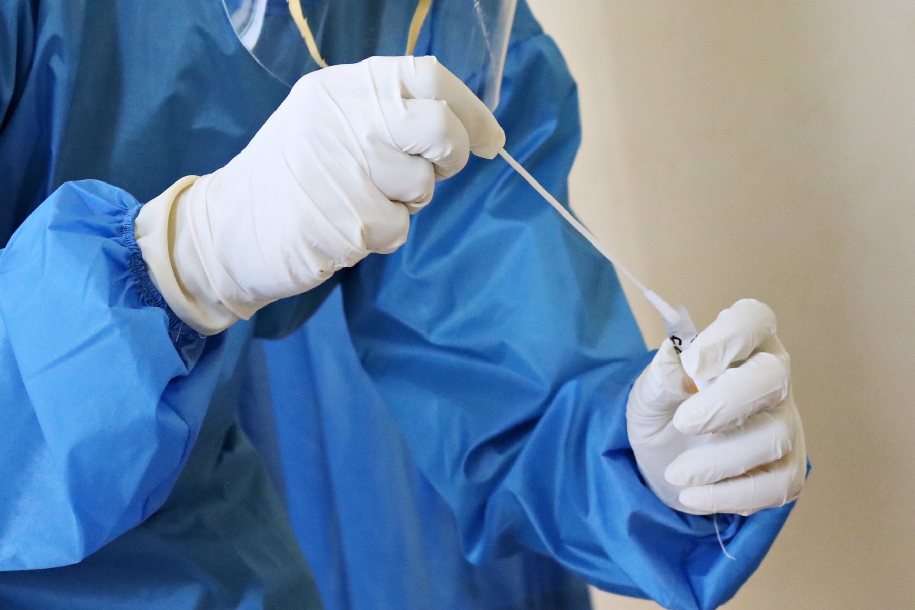 В Подмосковье после перенесенного коронавируса выздоровели еще 364 жителя за сутки